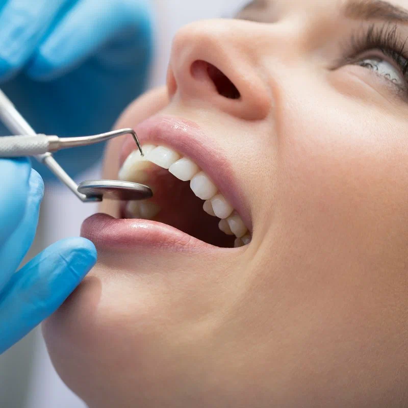 Dental Implant Tooth