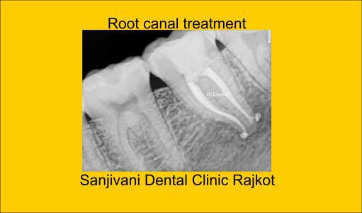 Hi-Tech Dental Chairs