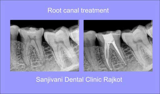 Hi-Tech Dental Chairs