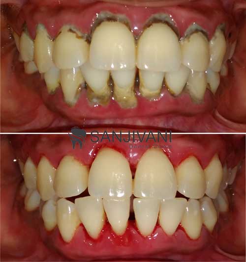 Hi-Tech Dental Chairs