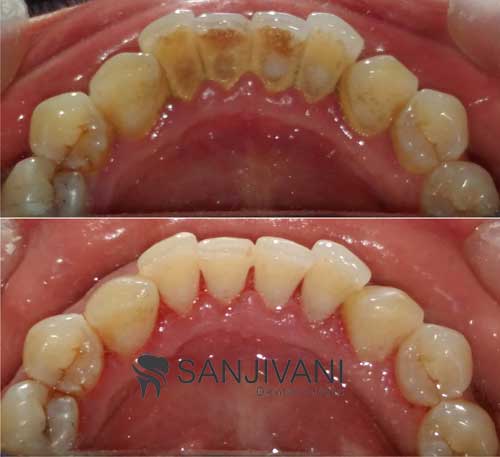 Hi-Tech Dental Chairs