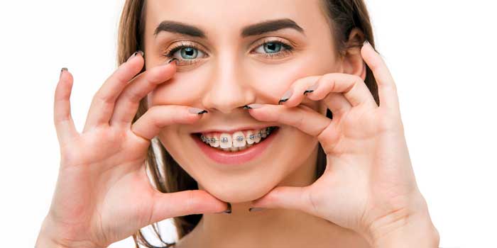 Dental Implant