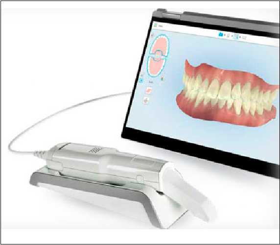 Intra Oral Camera