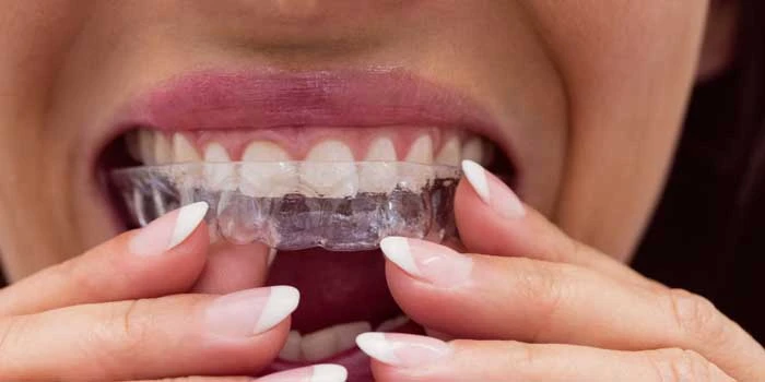 Tooth Removal