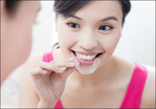 Dental Treatment 2 clear aligner in rajkot