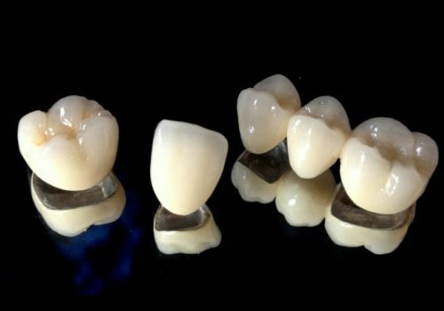 Dental Treatment 10 Dental crown