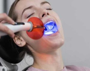 laser tooth whitening in rajkot