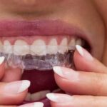 Dental Tourism india 3 invisalign-ortho-treatment-in-rajkot