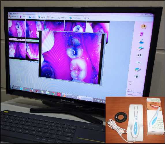 Our Technology 4 intra oral camera in rajkot