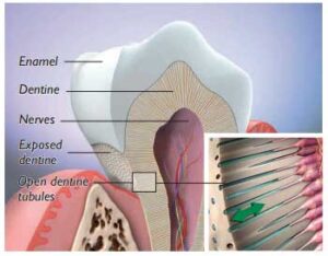 sensitive-teeth-to-water