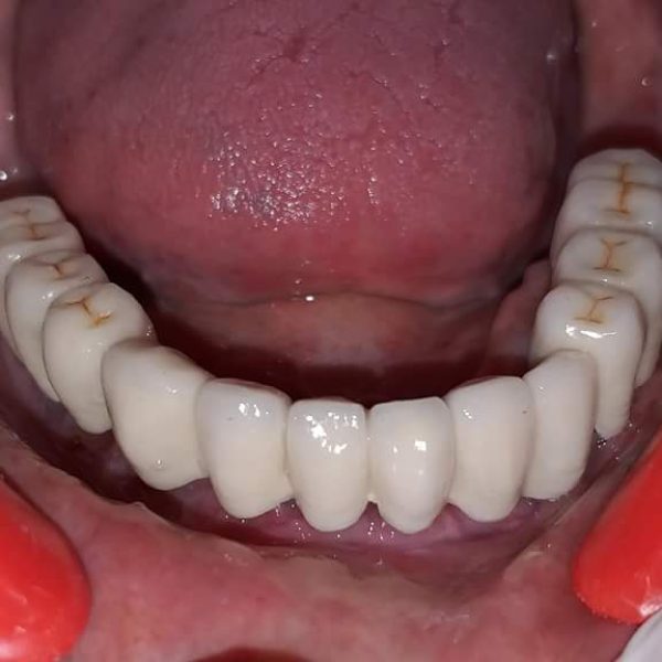 FB_IMG_1537685545752